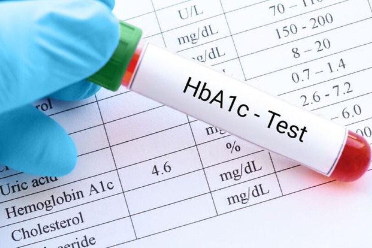 HbA1c Testing
